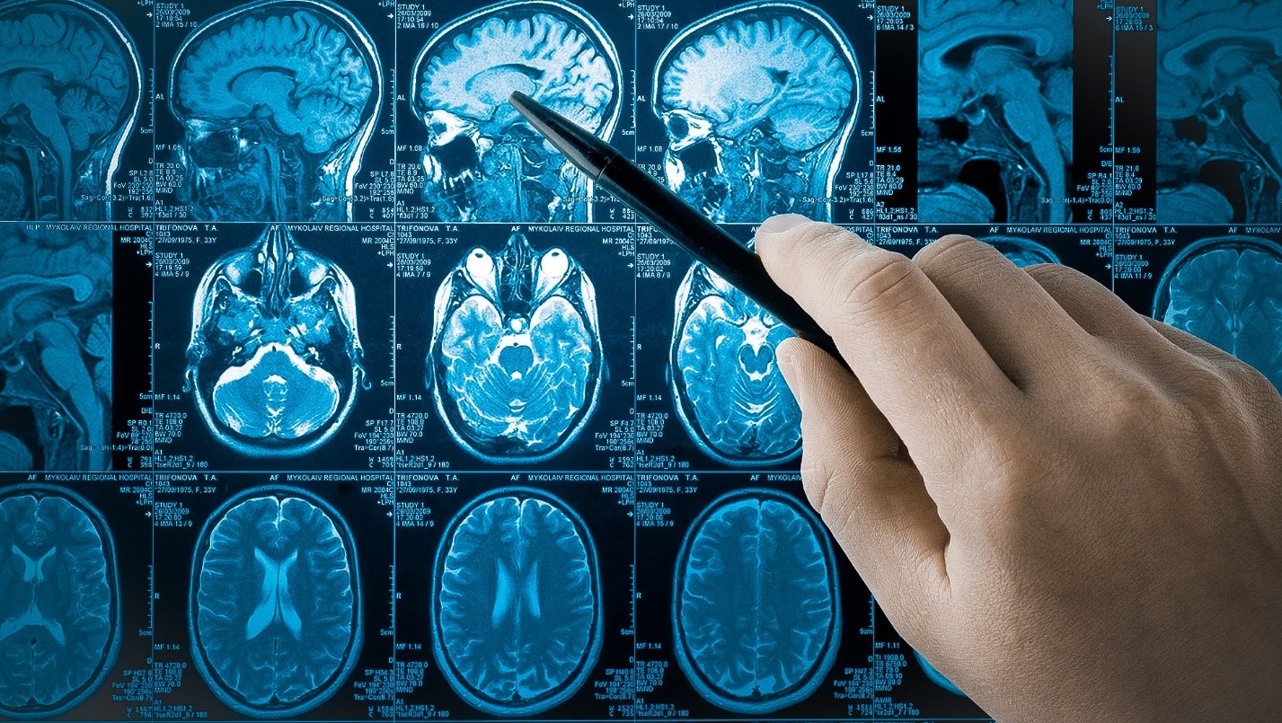 Нейропсихология – важная часть реабилитации пациентов с повреждениями ЦНС 